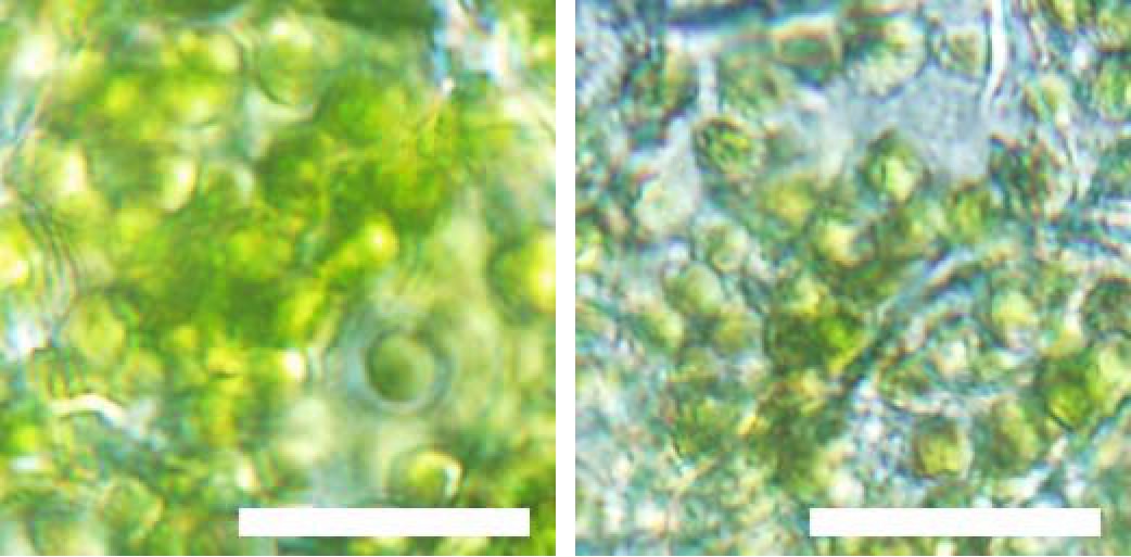 スイカの皮の拡大顕微鏡写真（左：黒い部分、右：緑の部分）