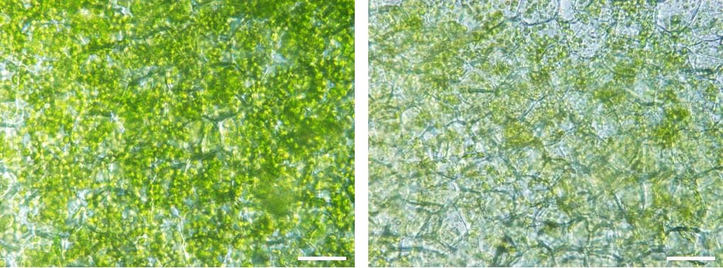 スイカの皮の顕微鏡写真（左：黒い部分、右：緑の部分）